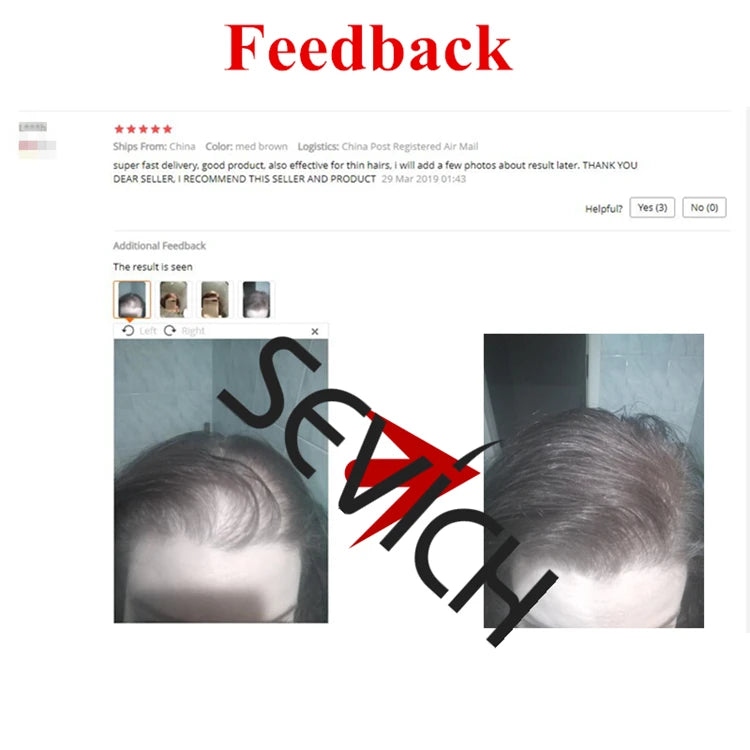 Sevich Hair Fibers 10 Color Keratin Hair Building Fiber Powder Instant Hair Growth