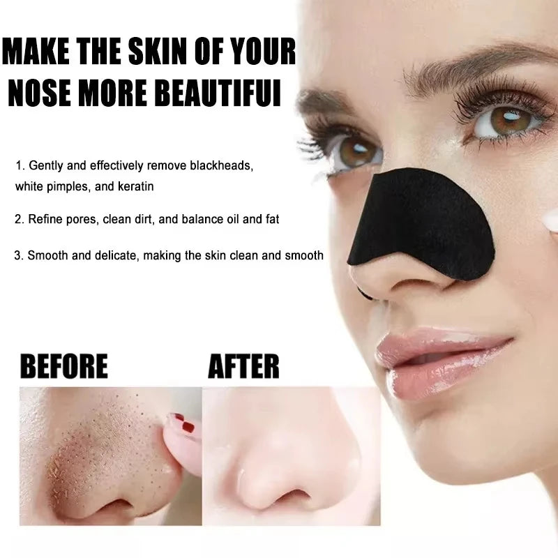 Blackhead Removal Strips – Deep Cleansing Pore Strips for a Clearer Nose