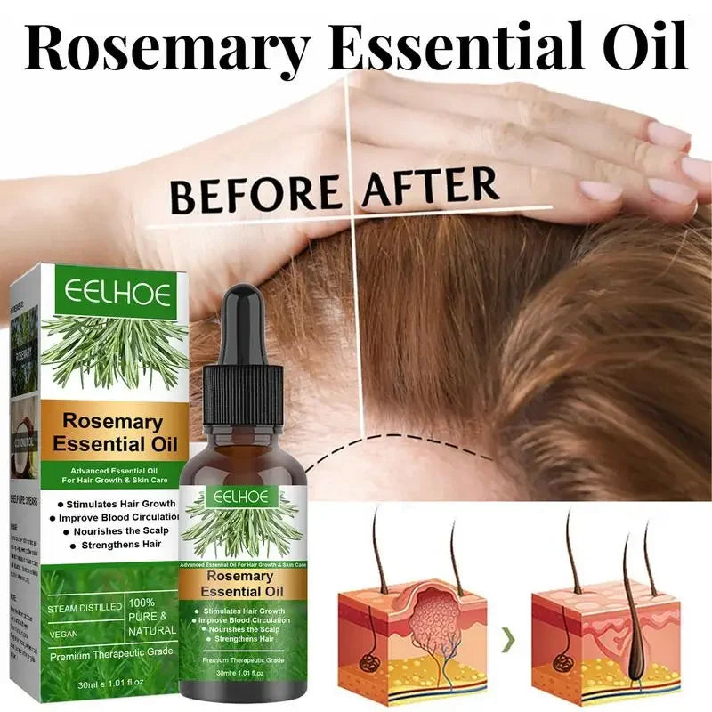 Rosemary Essential Oil for Hair Growth – Strengthen & Nourish Your Hair Naturally