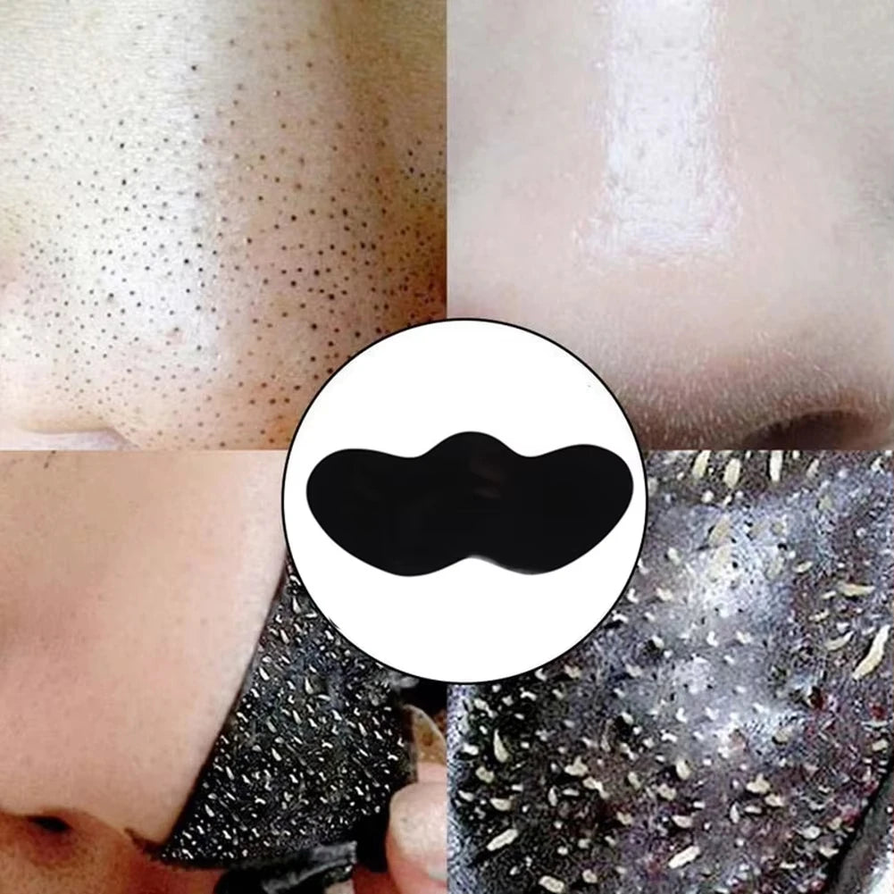 Blackhead Removal Strips – Deep Cleansing Pore Strips for a Clearer Nose