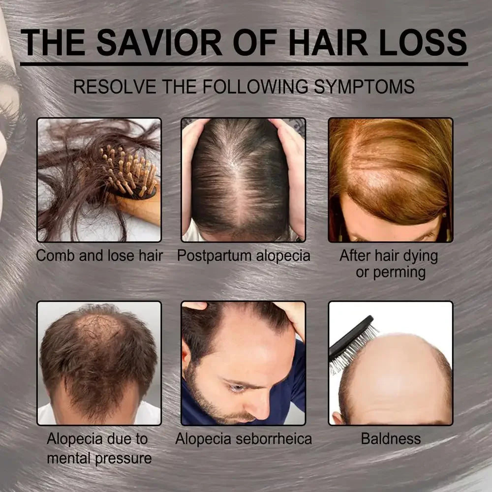Rosemary Essential Oil for Hair Growth – Strengthen & Nourish Your Hair Naturally