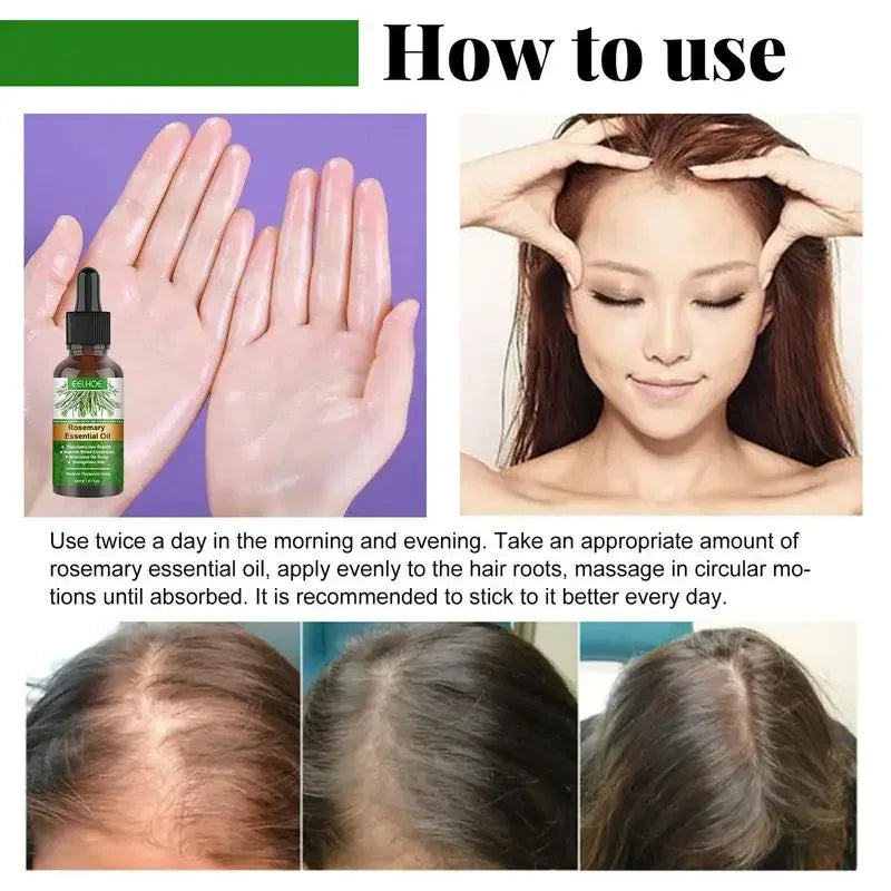 Rosemary Essential Oil for Hair Growth – Strengthen & Nourish Your Hair Naturally
