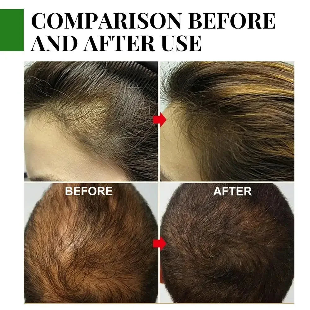 Rosemary Essential Oil for Hair Growth – Strengthen & Nourish Your Hair Naturally