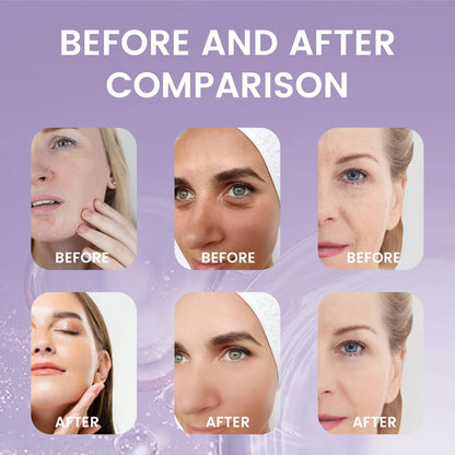 Bakuchiol Serum – Retinol Alternative with Hyaluronic Acid for Firm, Hydrated Skin