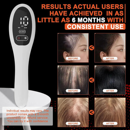 Electric Laser Hair Growth Comb Anti Hair Loss Therapy Comb