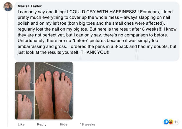 Product review with before and after images of feet, showing nail polish application.

